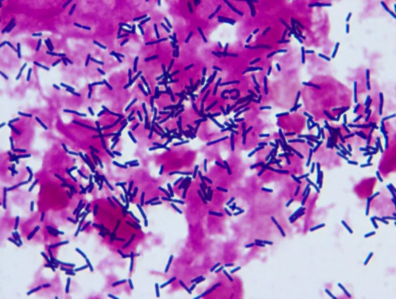 疾控中心微生物檢測(cè)實(shí)驗(yàn)室顯微鏡應(yīng)用