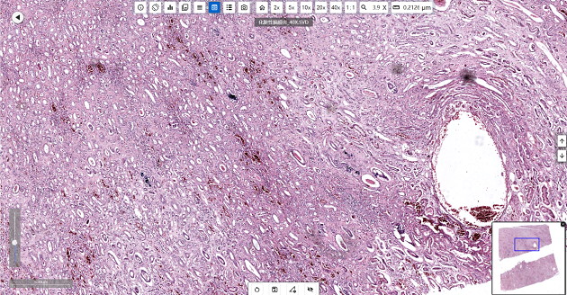 疾控中心病理學(xué)實(shí)驗(yàn)室的顯微鏡應(yīng)用