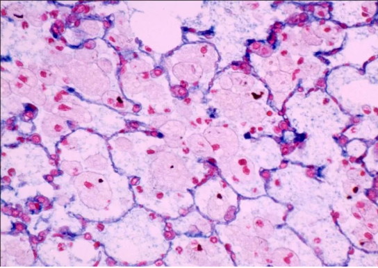 疾控中心職業(yè)衛(wèi)生實(shí)驗(yàn)室的顯微鏡應(yīng)用